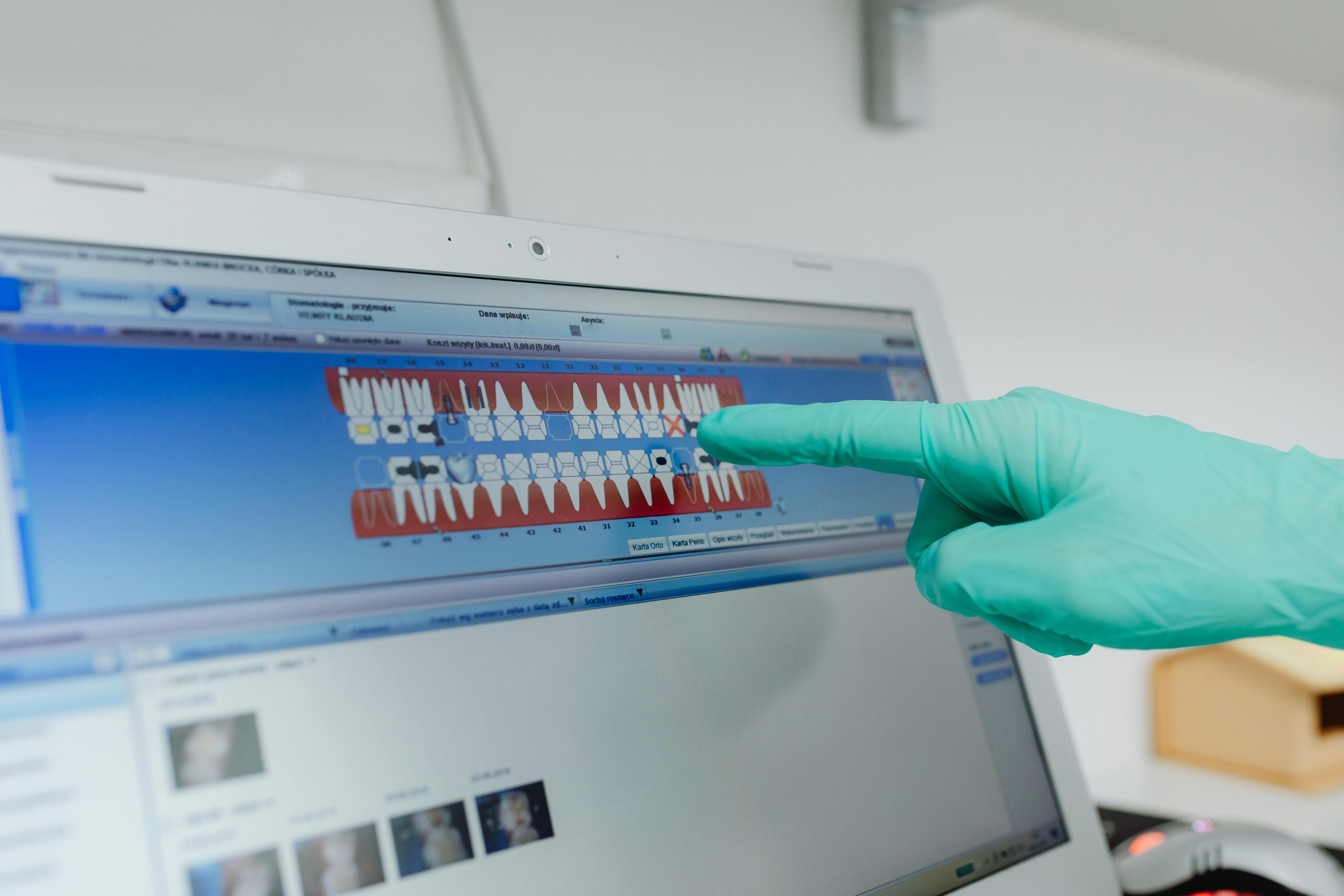 Perio Charting - BetterDiagnostics