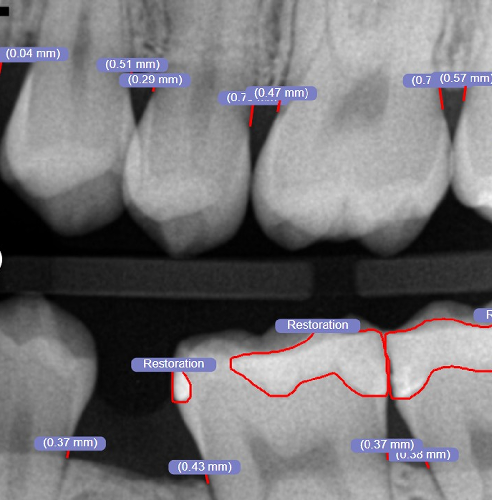 AI Xray Diagnostics